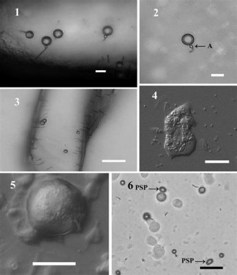  Protostelium! An Intriguing Amoeboid Wanderer Navigating its Microcosmic World with Tentacle-like Pseudopods